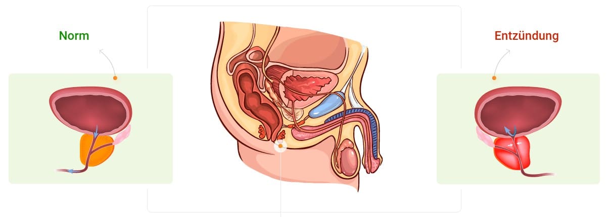 urotrin Erfahrungen